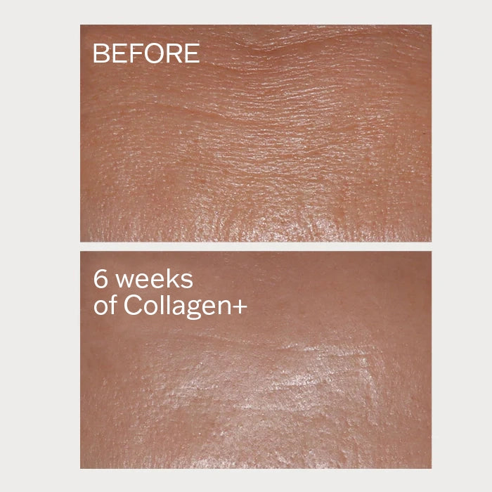Collagen+